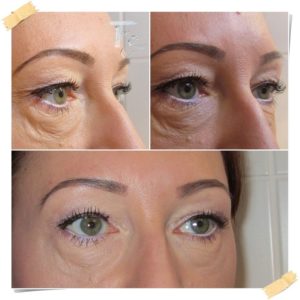 Wimpernwelle